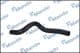 mcc020093 Mando Патрубок радіатора системи охолодження двигуна для Hyundai Santa Fe