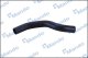 DCC020221 Mando Патрубок радиатора системы охлаждения двигателя для Hyundai Santa Fe