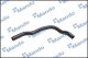 DCC020716 Mando Патрубок радиатора системы охлаждения двигателя для Hyundai Sonata