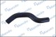 DCC020221 Mando Патрубок радиатора системы охлаждения двигателя для Hyundai Santa Fe